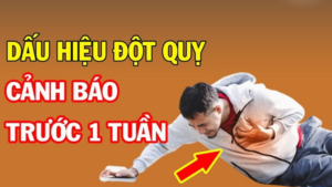 dấu hiệu đột quỵ trước 1 tuần