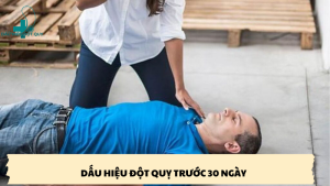 dấu hiệu đột quỵ trước 30 ngày