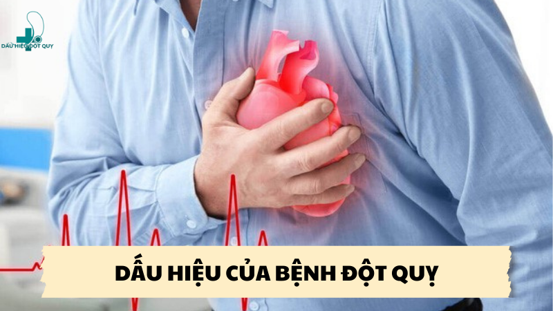 dấu hiệu của bệnh đột quỵ